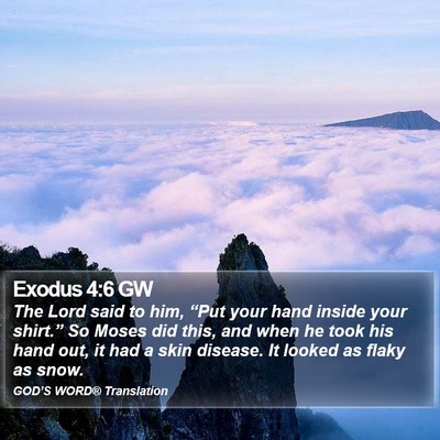 Exodus 4:6 GW Bible Verse Image