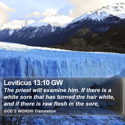 Leviticus 13:10 GW Bible Verse Image