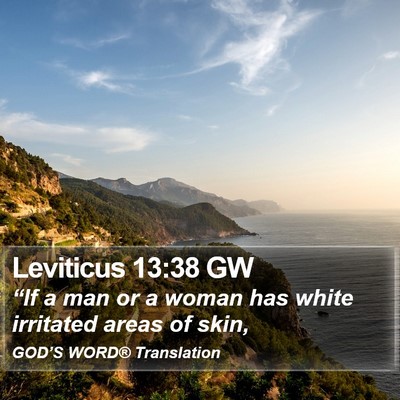 Leviticus 13:38 GW Bible Verse Image