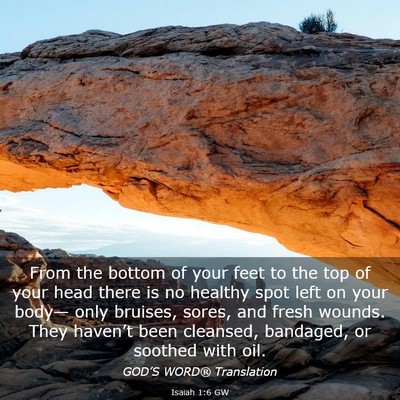 Picture 03 - Isaiah 1:6 GW - From the bottom of your feet to the top of your - Bible Verse Picture