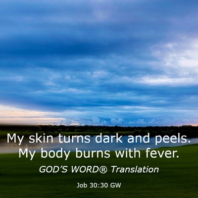 Picture 03 - Job 30:30 GW - My skin turns dark and peels. My body burns with - Bible Verse Picture