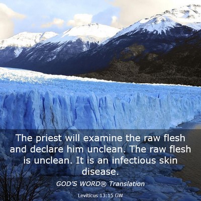 Picture 03 - Leviticus 13:15 GW - The priest will examine the raw flesh and declare - Bible Verse Picture
