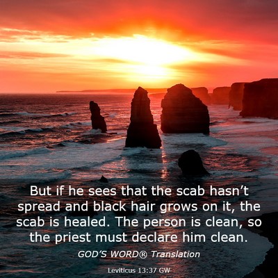 Picture 03 - Leviticus 13:37 GW - But if he sees that the scab hasn’t spread and - Bible Verse Picture