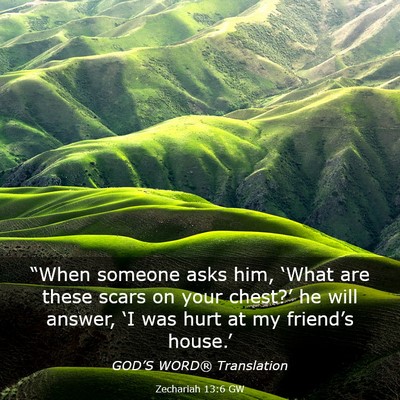 Picture 03 - Zechariah 13:6 GW - “When someone asks him, ‘What are these scars - Bible Verse Picture