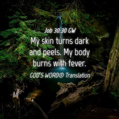 Picture 04 - Job 30:30 GW - My skin turns dark and peels. My body burns with - Bible Verse Picture